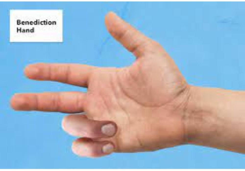 Benediction hand
