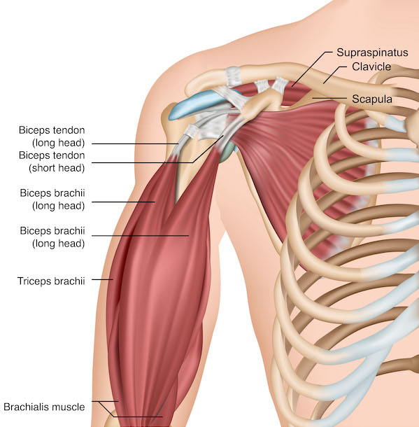 Biceps Tendinitis