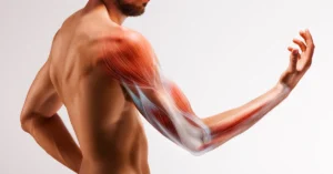 Biceps-Tendon-Rupture-Treatment