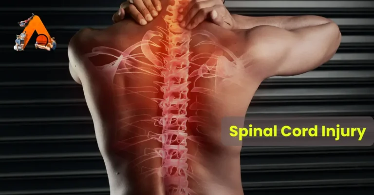 Spinal Cord Injury
