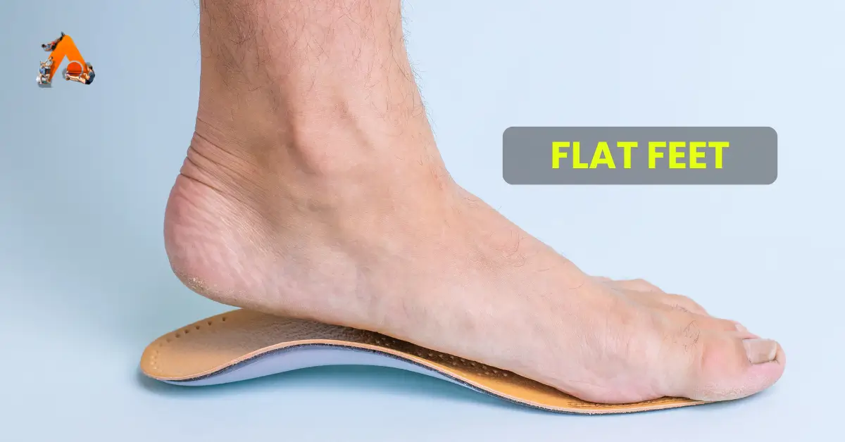 flat feet