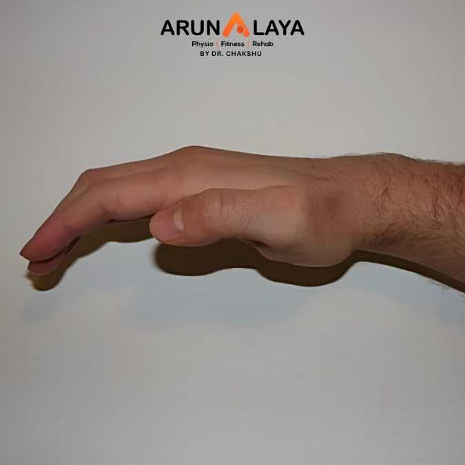 Ape Hand treatment at Arunalaya