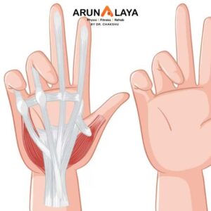 Benediction Hand treatment at Arunalaya