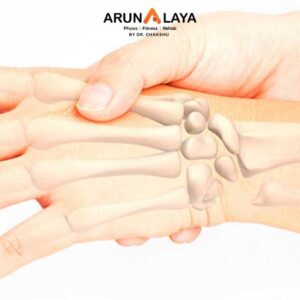 Bennett’s fracture treatment at Arunalaya