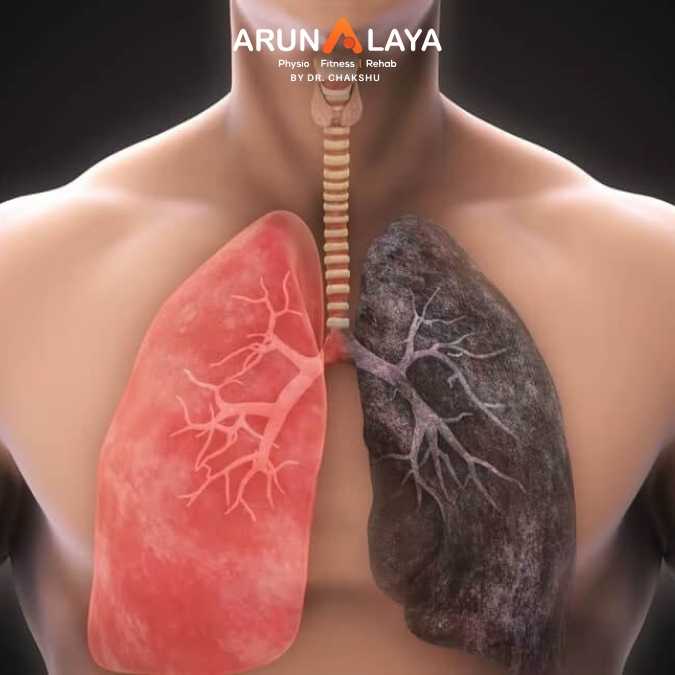 COPD ( chronic obstructive pulmonary disease) treatment at Arunalaya