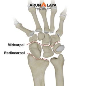 Carpal instability treatment at Arunalaya