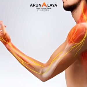 Cervical Radiculopathy treatment