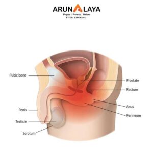 Chronic pelvic pain syndrome treatment at Arunalaya