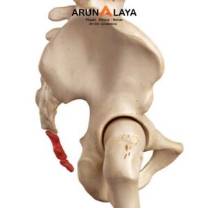 Coccyx Fracture treatment at Arunalaya