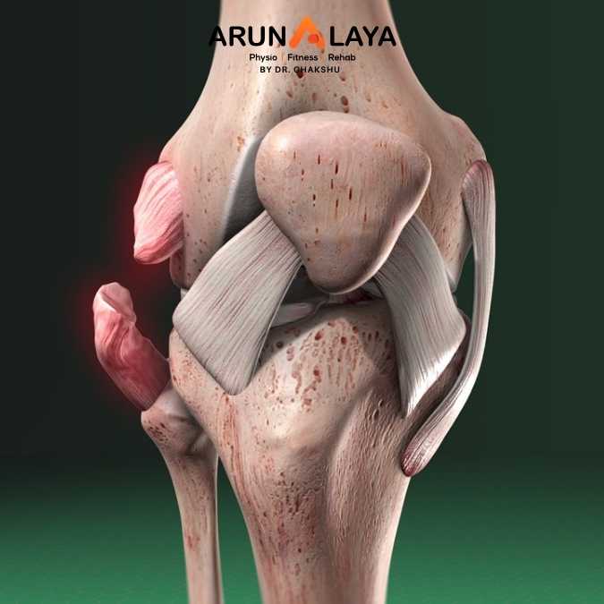 Collateral Ligament treatment at Arunalaya