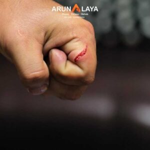 Contusion and laceration treatment At Arunalaya