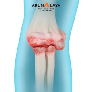 Elbow osteoarthritis treatment at Arunalaya