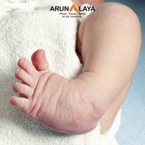 klumpke paralysis treatment and cure