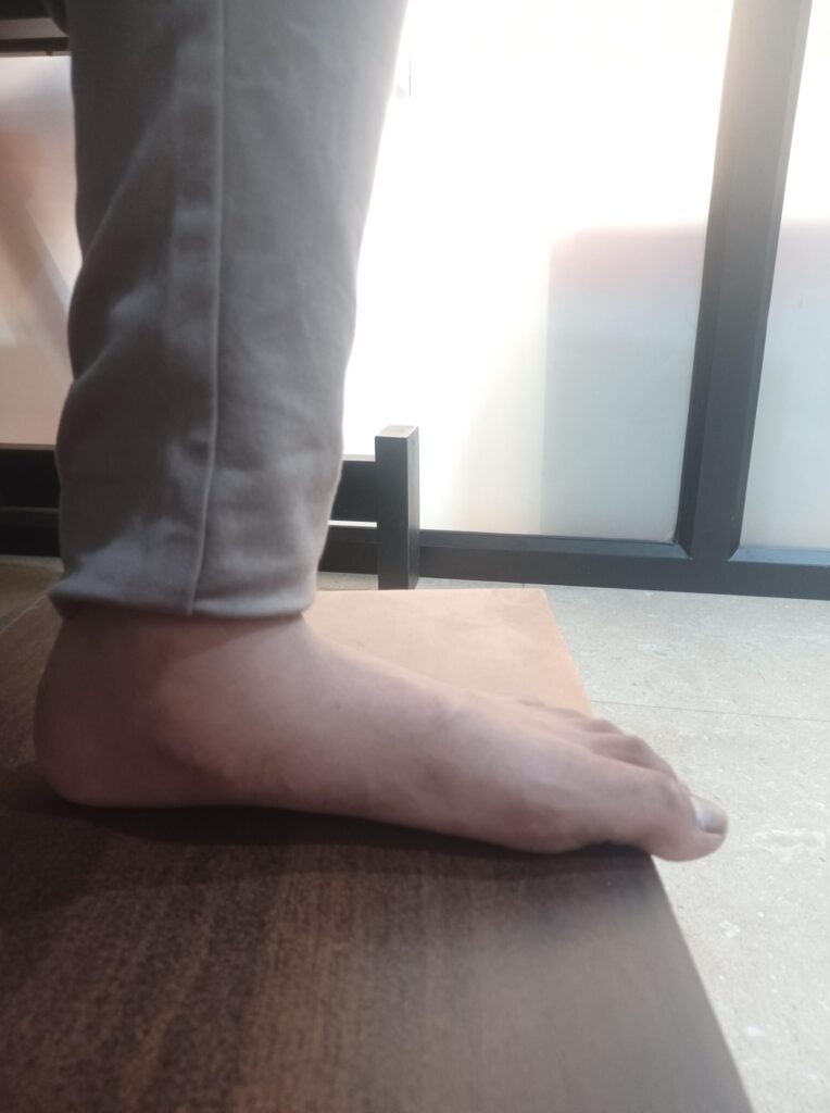 flat foot rehabilitation