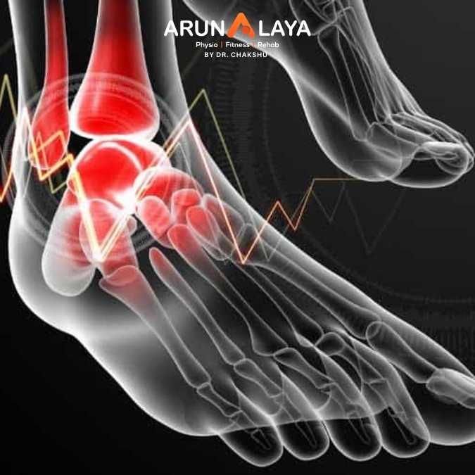 Ankle Osteochondral Lesions treatment at Arunalaya