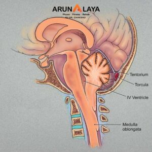 Arnold Chiari Malformation treatment at Arunalaya