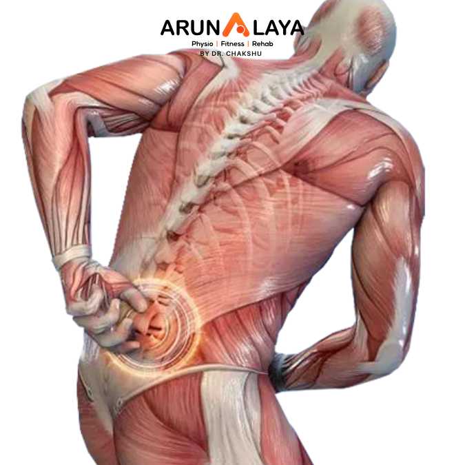 Back strain treatment and cure