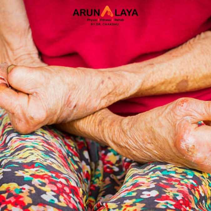 LEPROS treatment and cure