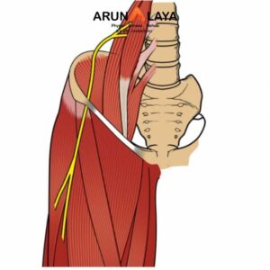 Meralgia treatment and cure