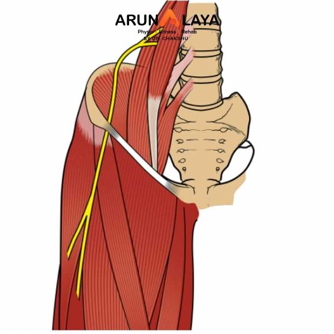 Meralgia treatment and cure
