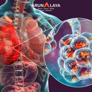 Pneumonia treatment and cure