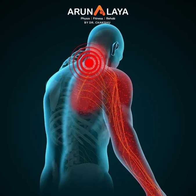 Radiculopathy treatment and cure