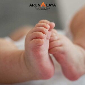 Recurrent Clubfoot treatment and cure