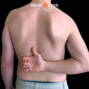 Scapular Dyskinesia treatment and cure