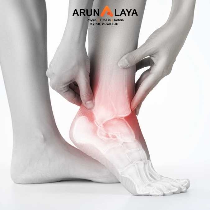 Sinus Tarsi Syndrome treatment and cure