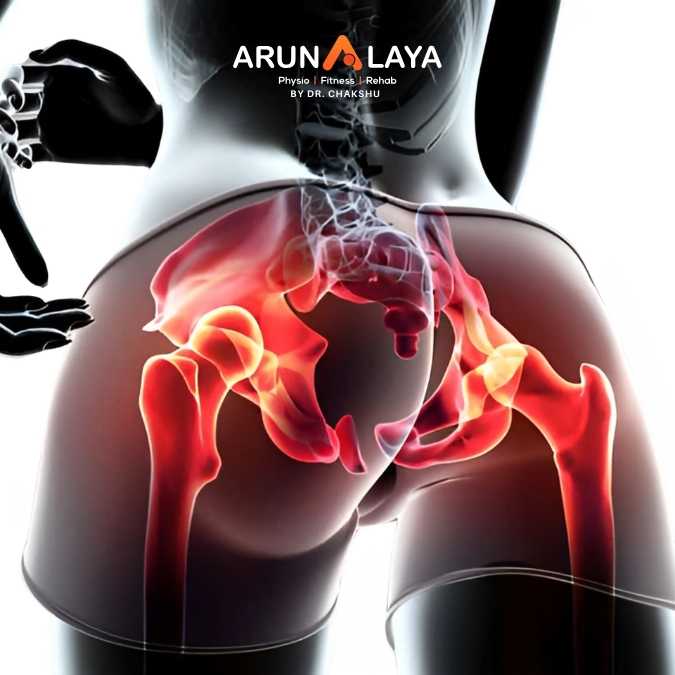 Snapping hip syndrome treatment and cure