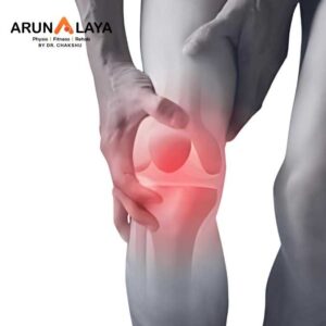 squinting of patella treatment and cure