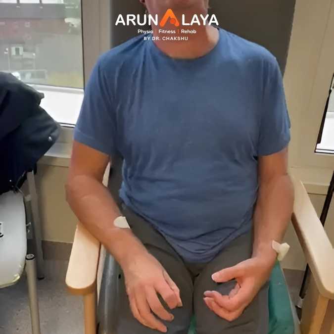 Stiff Person Syndrome treatment and cure