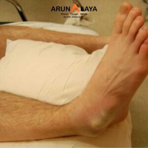 Subtalar dislocation treatment and cure