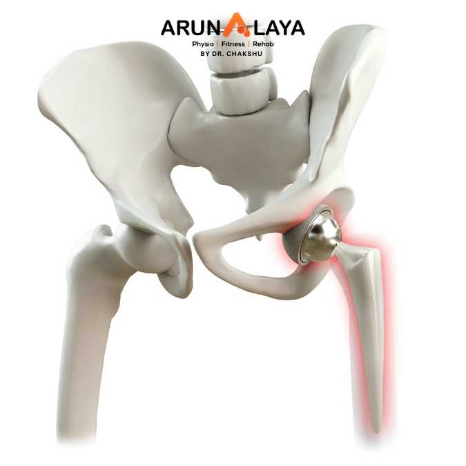 THR treatment and cure