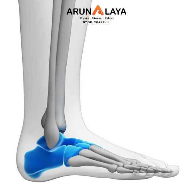 Tarsal Coalition treatment and cure