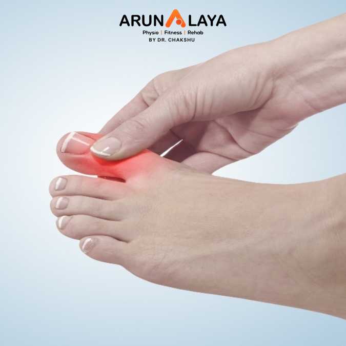 Turf toe treatment and cure