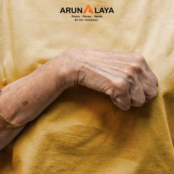 Volkmann’s contractures treatment and cure