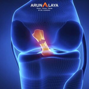 acl rupture treatment and cure