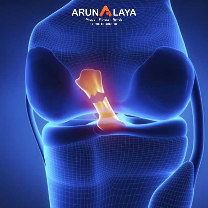 acl rupture treatment and cure