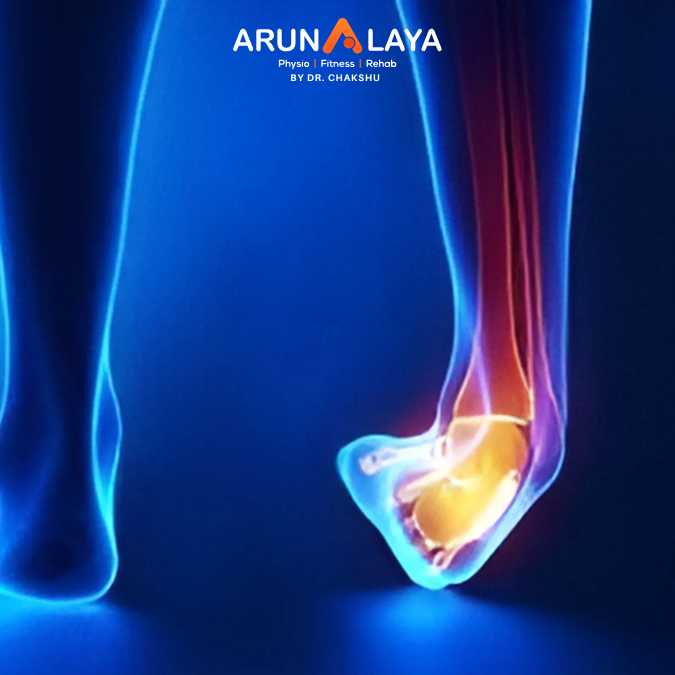 ankle fracture treatment and cure