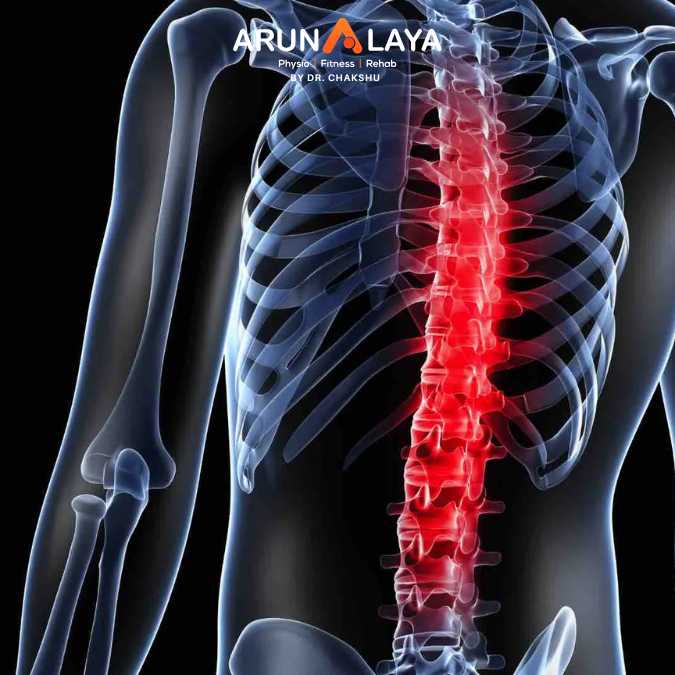 ankylosing spondylitis bursitis treatment and cure
