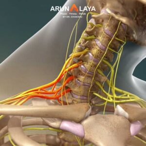 brachial plexus injury treatment and cure