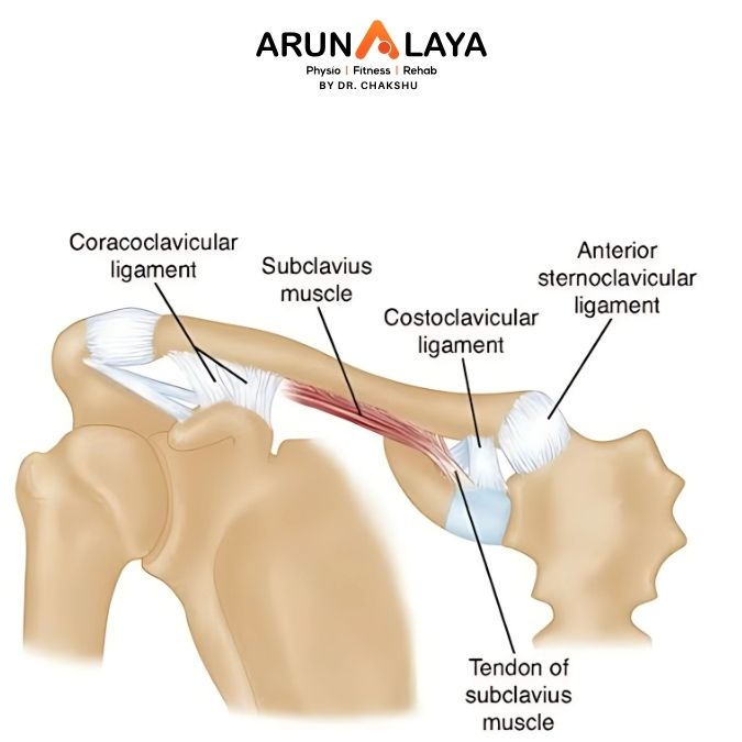 costro-clavicoar syndrome treatment and cure