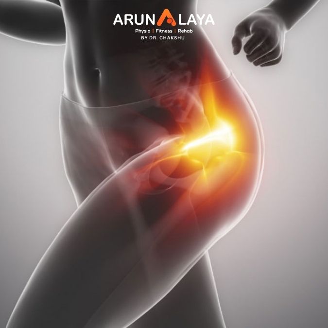 Gluteal Tendinopathy treatment and cure