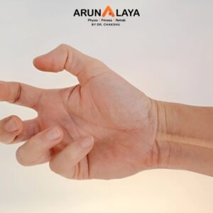 hand dystonia treatment and cure