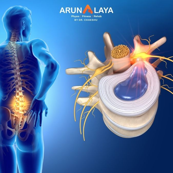herniated disc treatment and cure