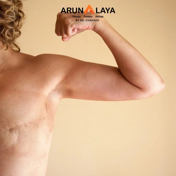 mastectomy treatment and cure