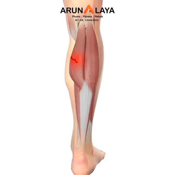 Muscle strain treatment and cure