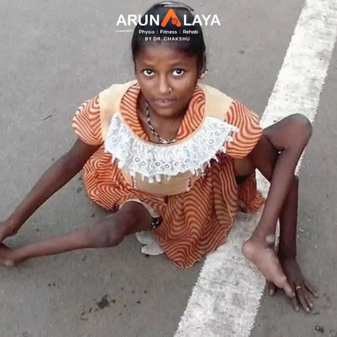 poliomyelitis treatment and cure