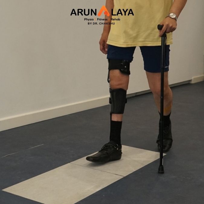 post polio syndrome treatment and cure